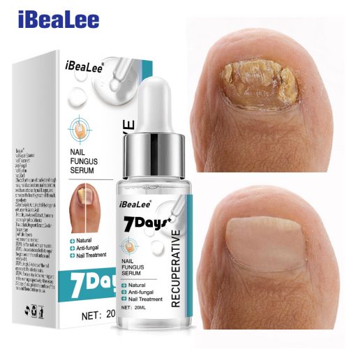 ibealee nail fungus serum