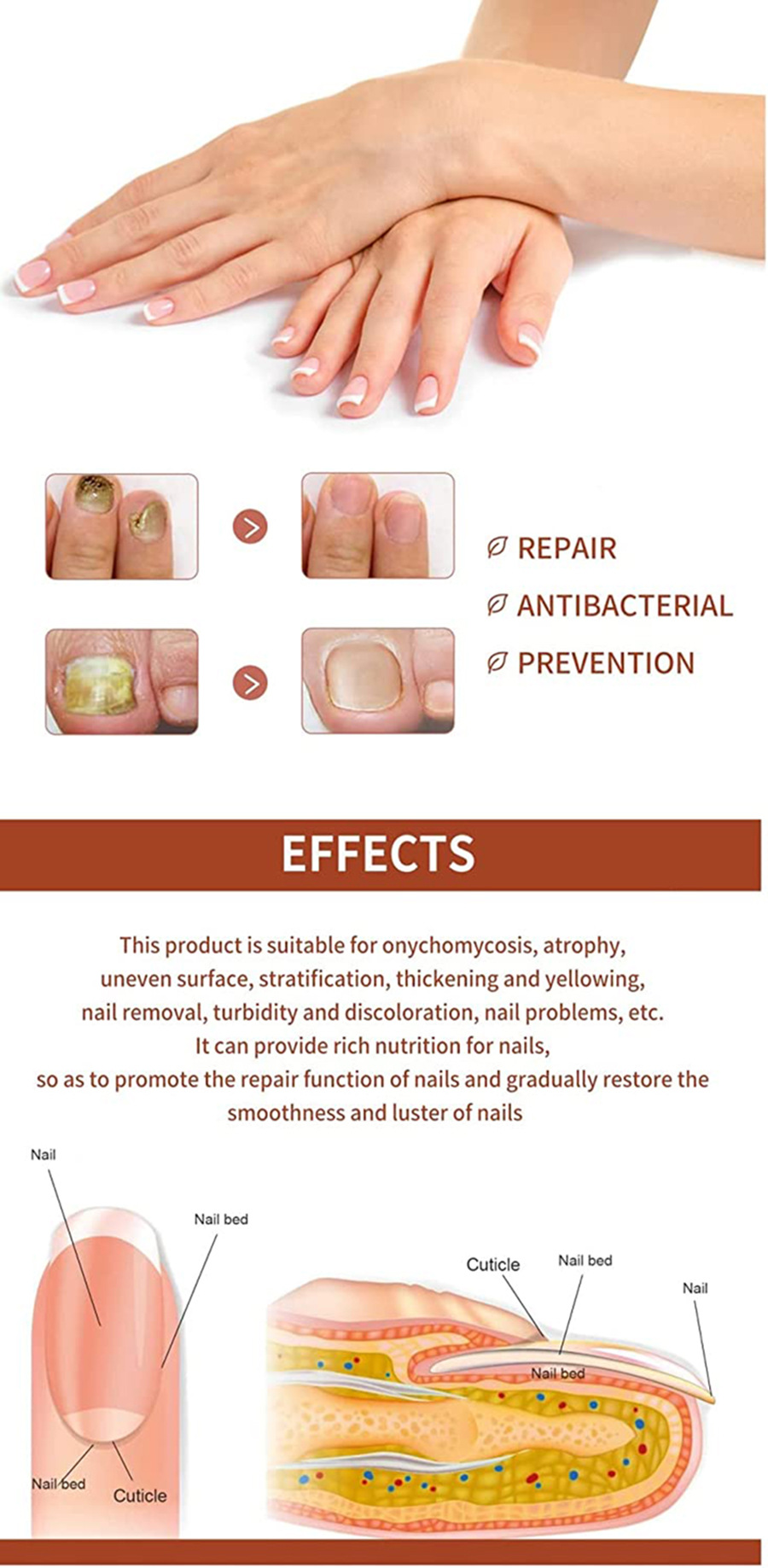 ibealee nail fungus serum